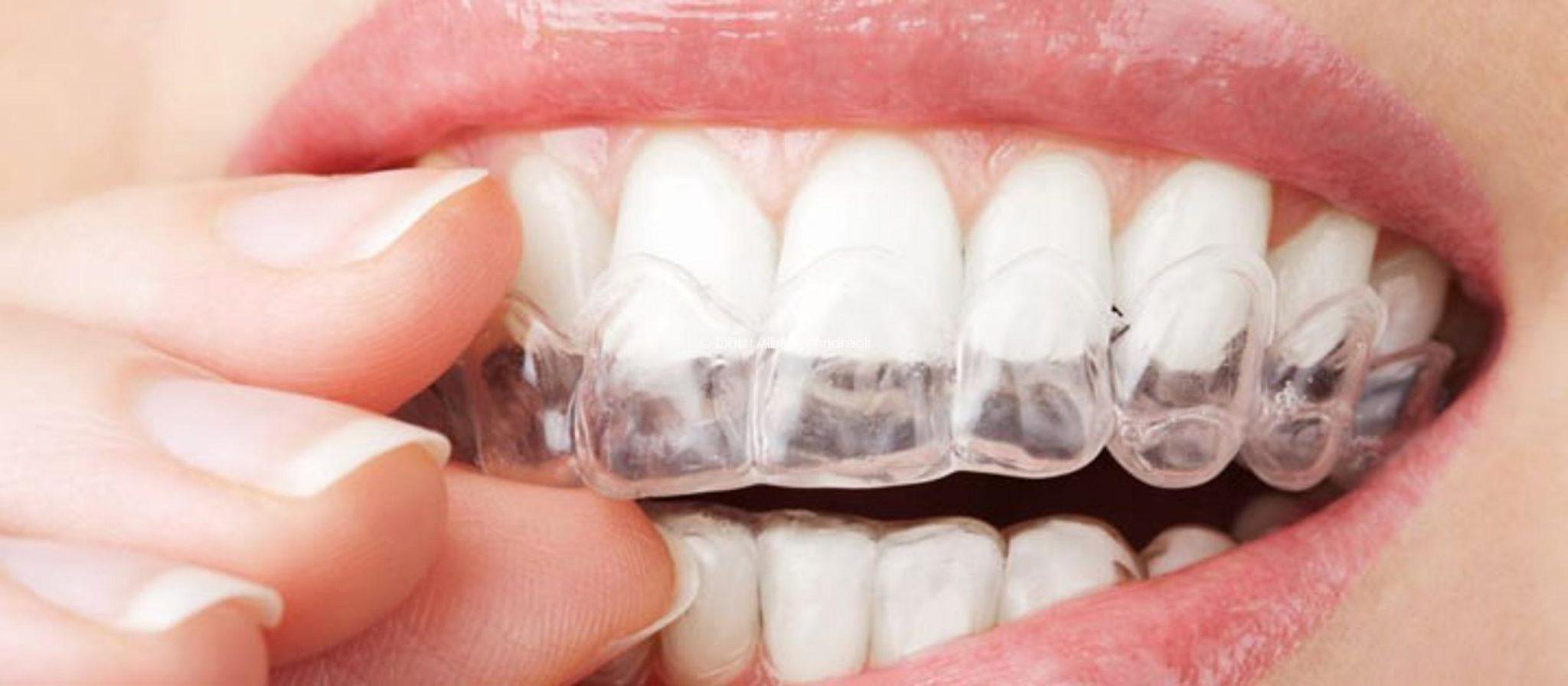 apparecchi-ortodontici
